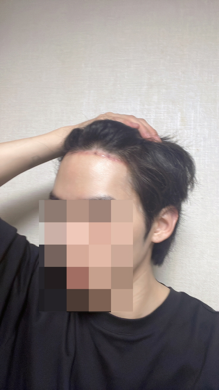 수술후기이미지