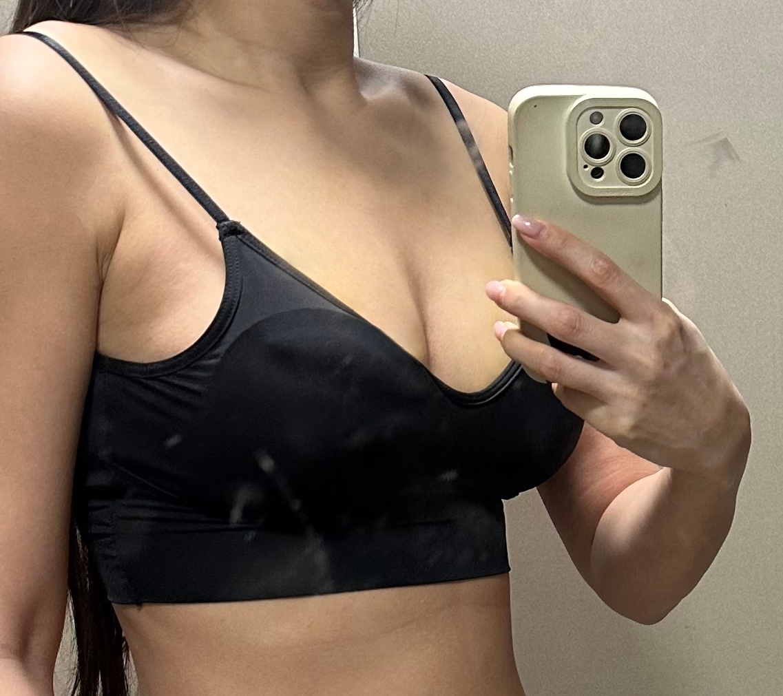 수술후기이미지