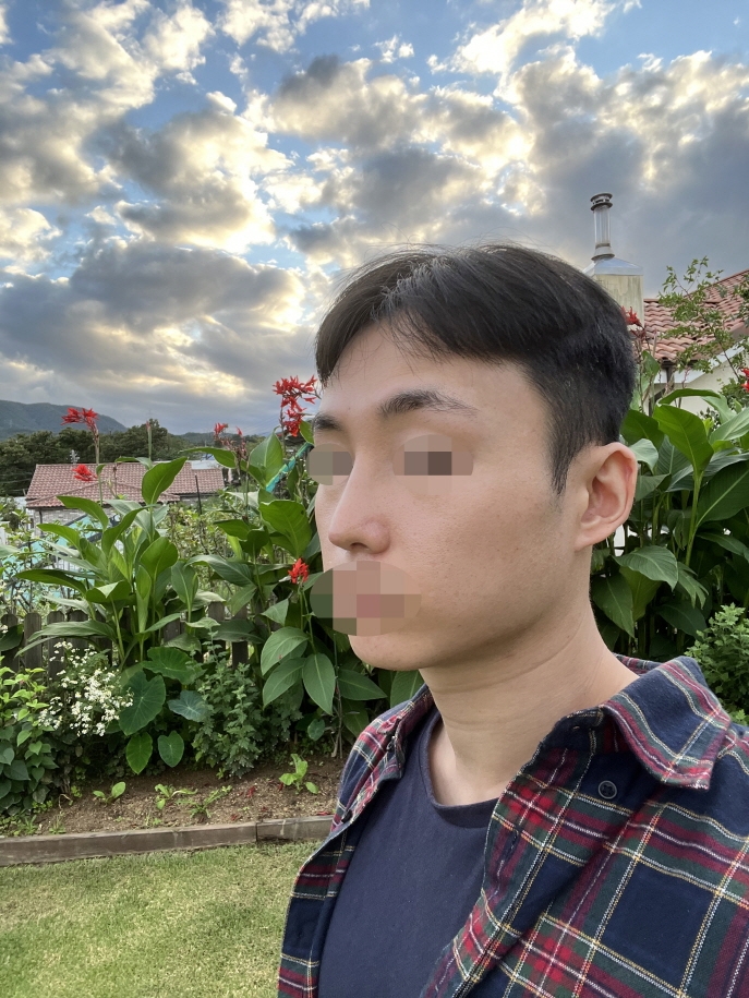 수술후기이미지