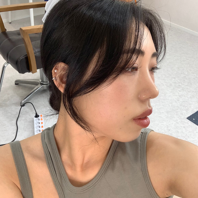 수술후기이미지