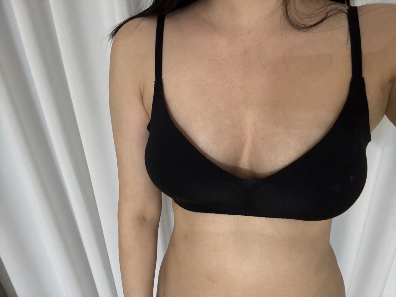 수술후기이미지