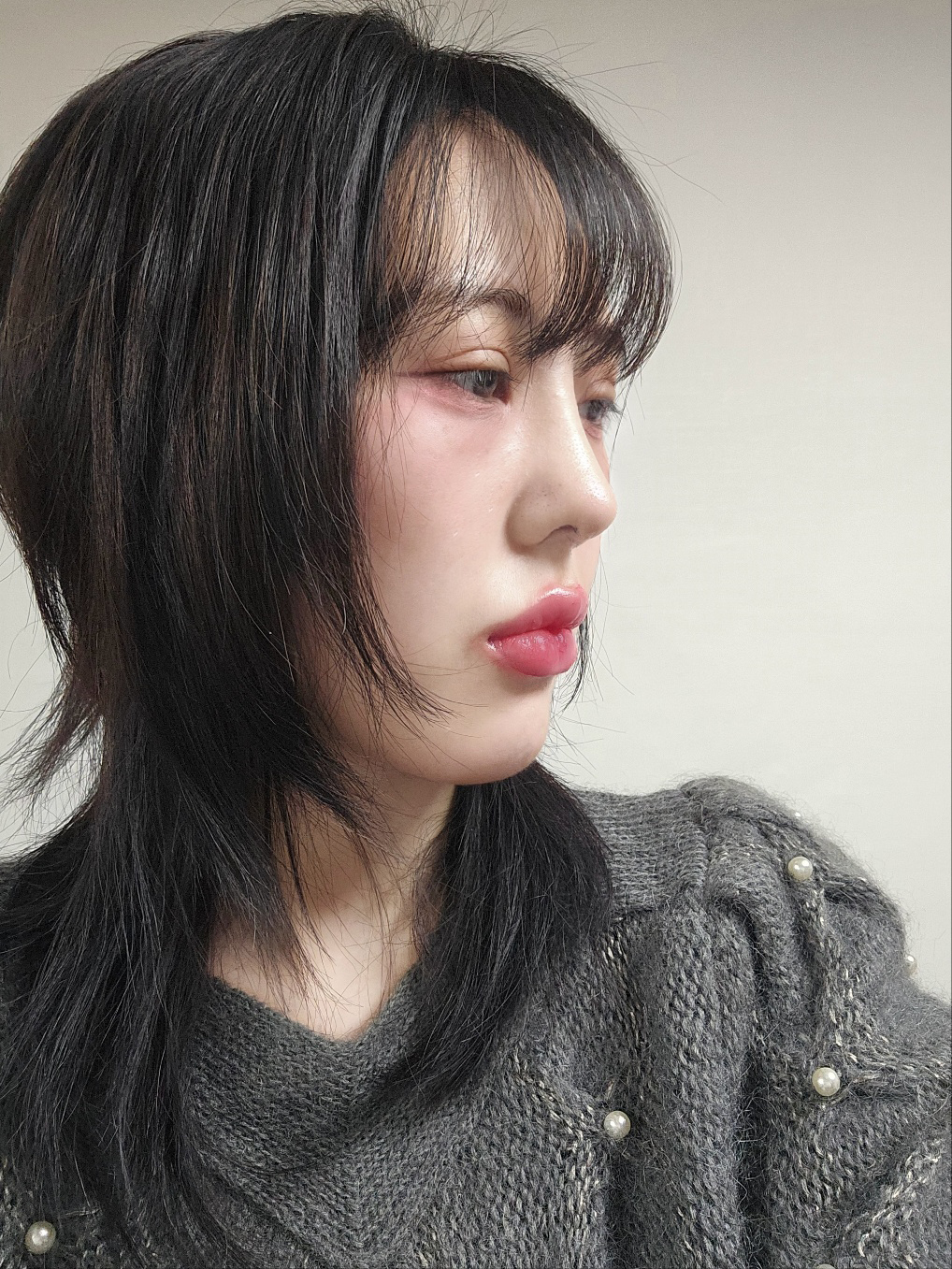 수술후기이미지