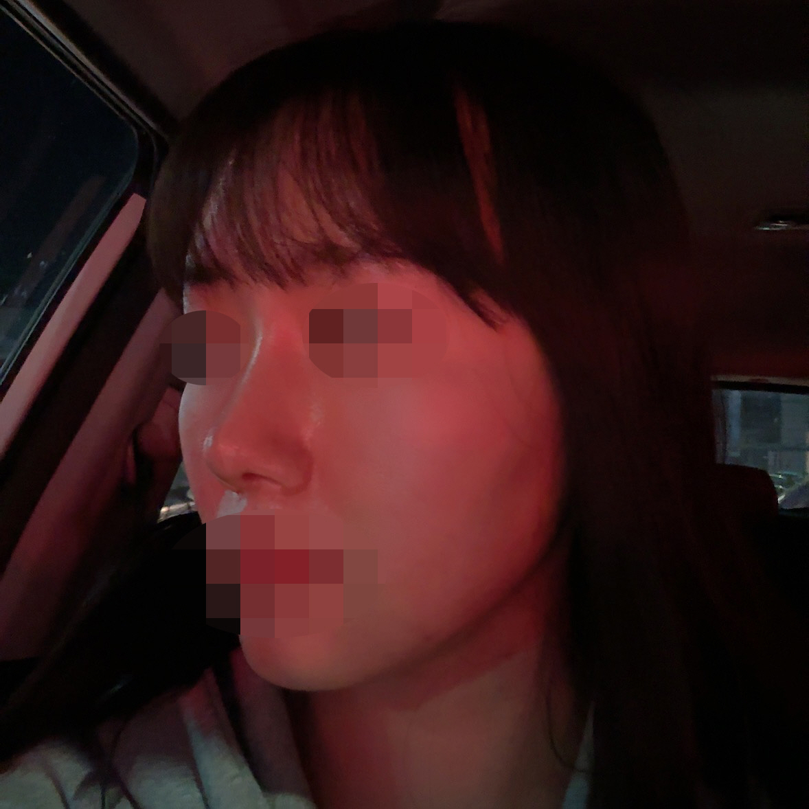 수술후기이미지