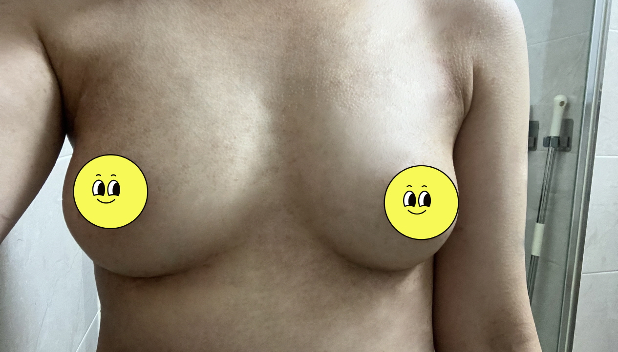 수술후기이미지