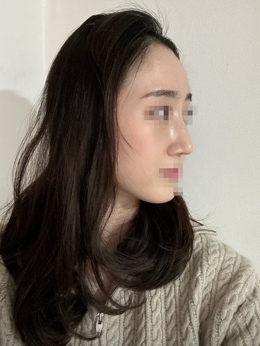 수술후기이미지