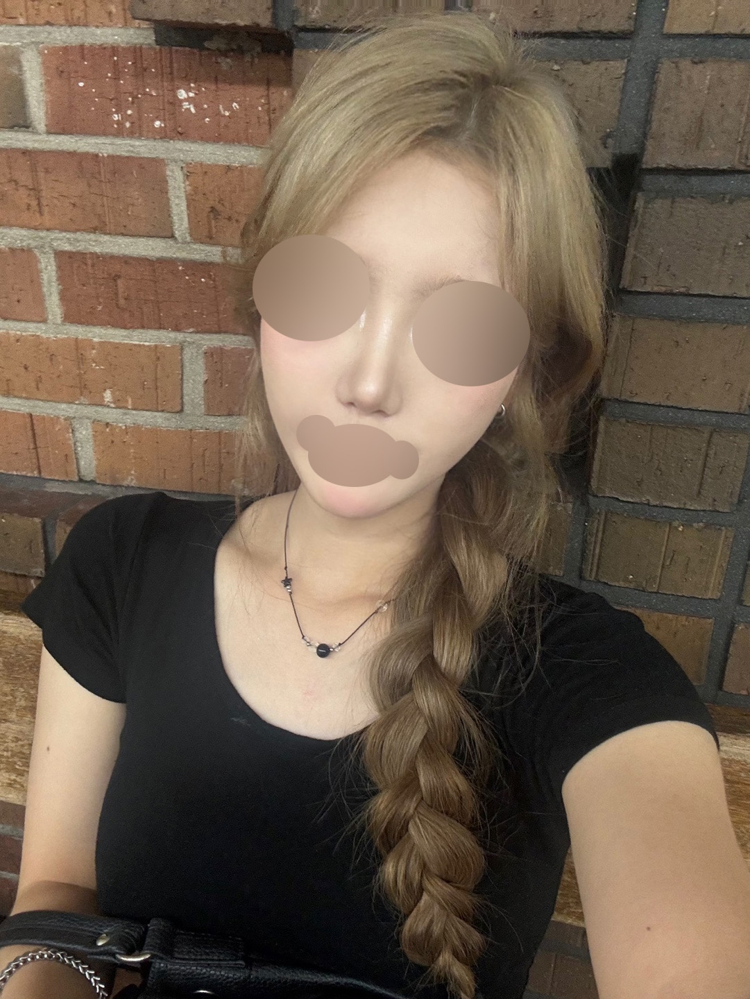 수술후기이미지