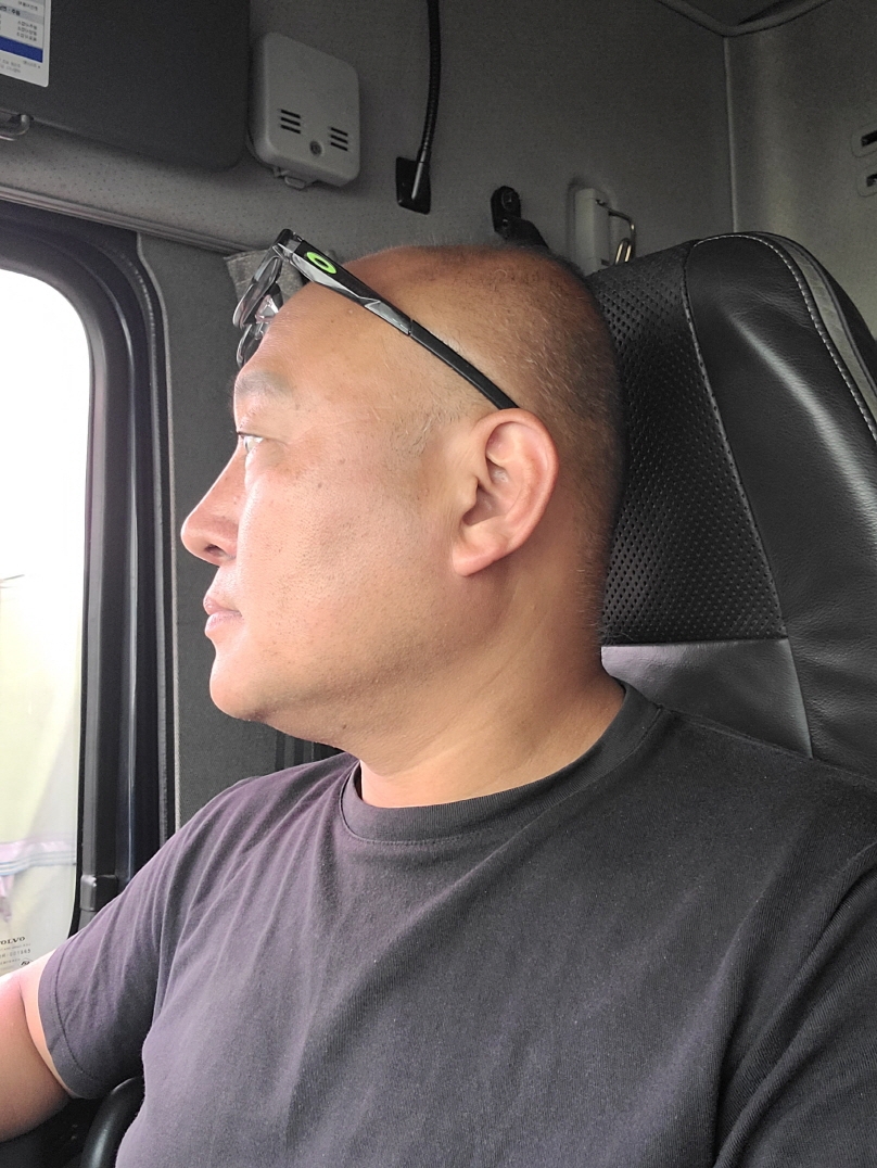 수술후기이미지