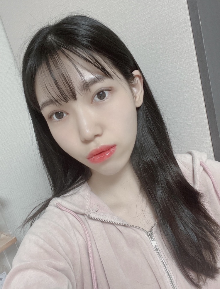 수술후기이미지