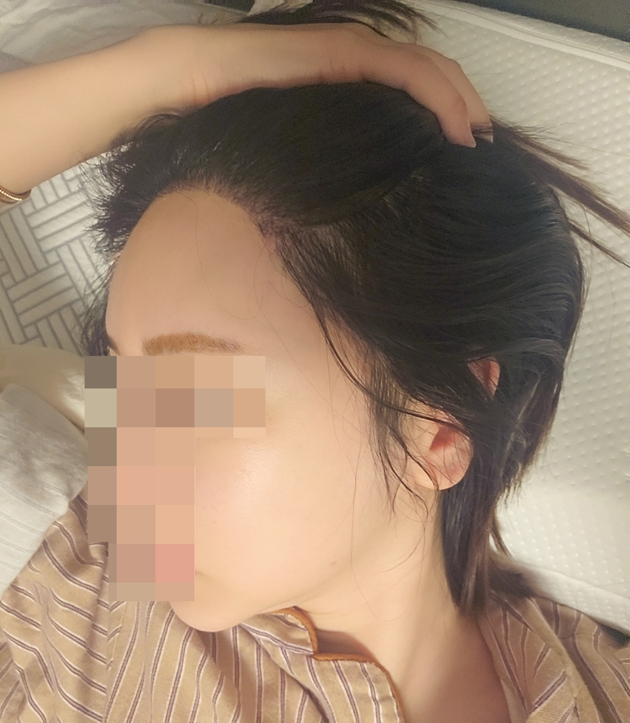 수술후기이미지