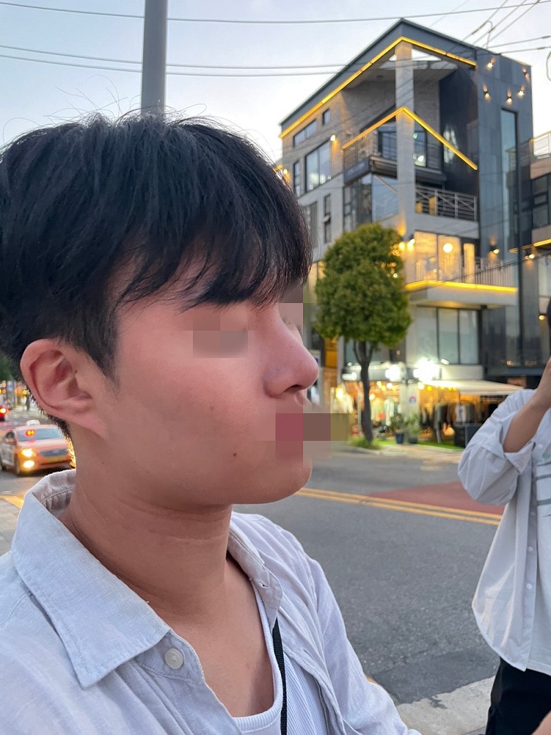 수술후기이미지