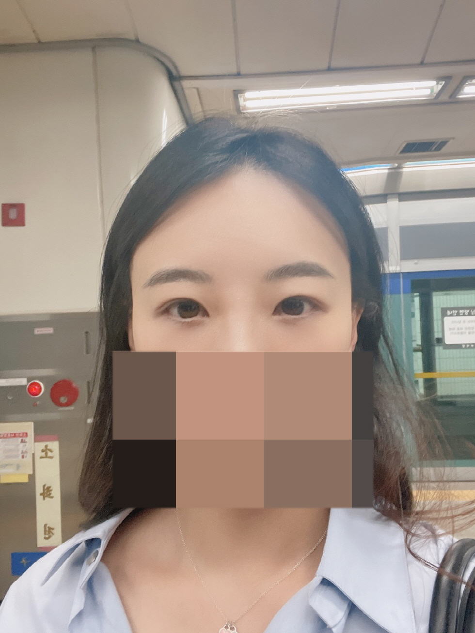 수술후기이미지