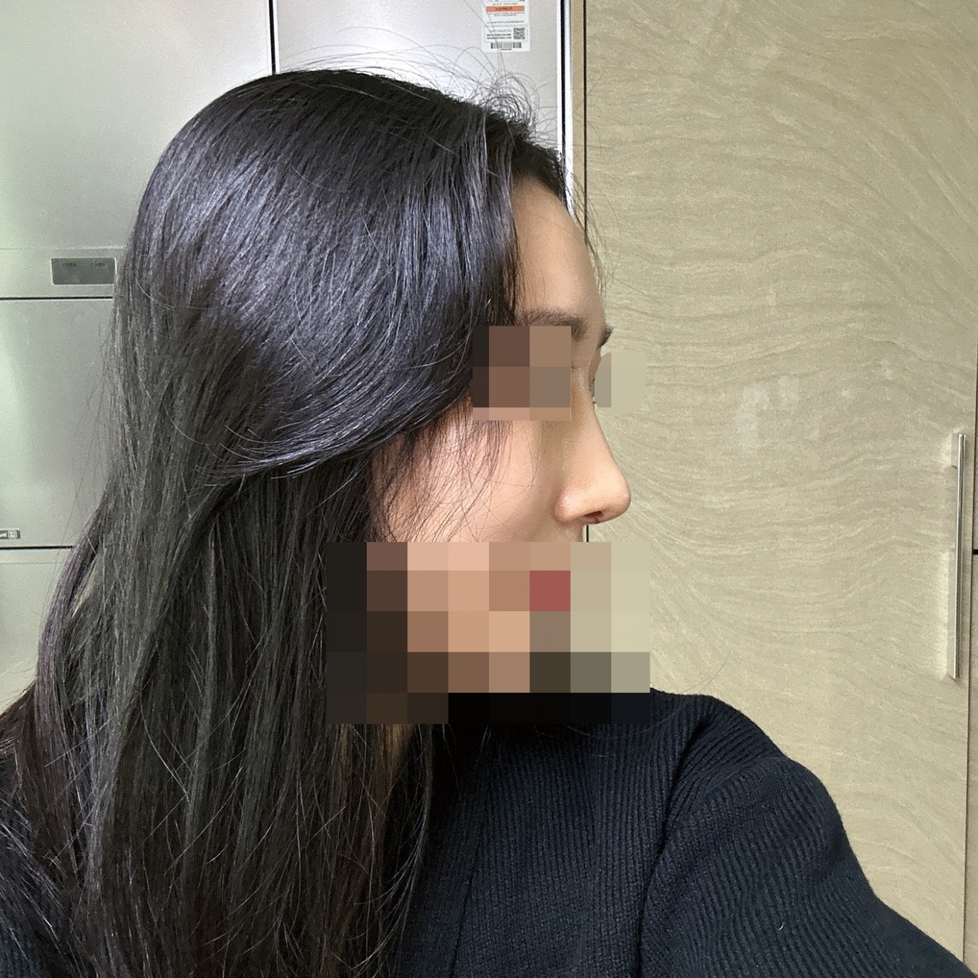 수술후기이미지