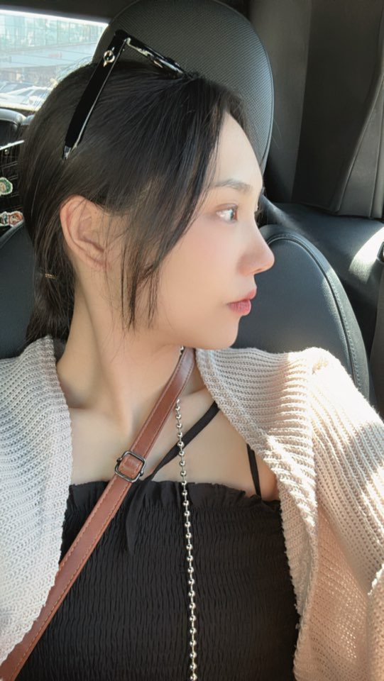 수술후기이미지