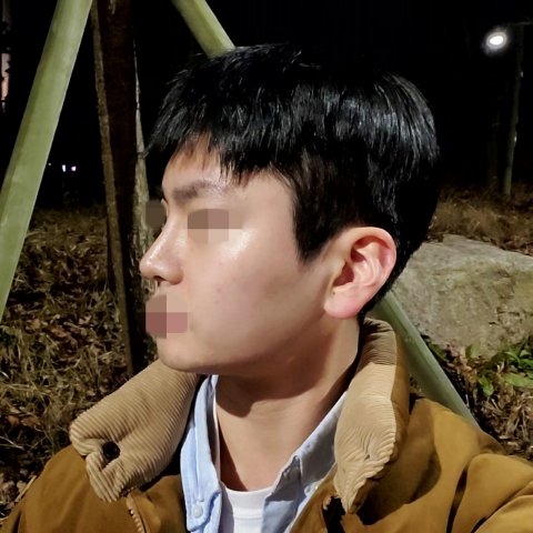 수술후기이미지