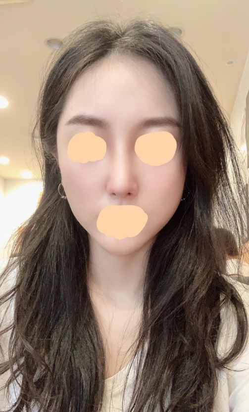 수술후기이미지