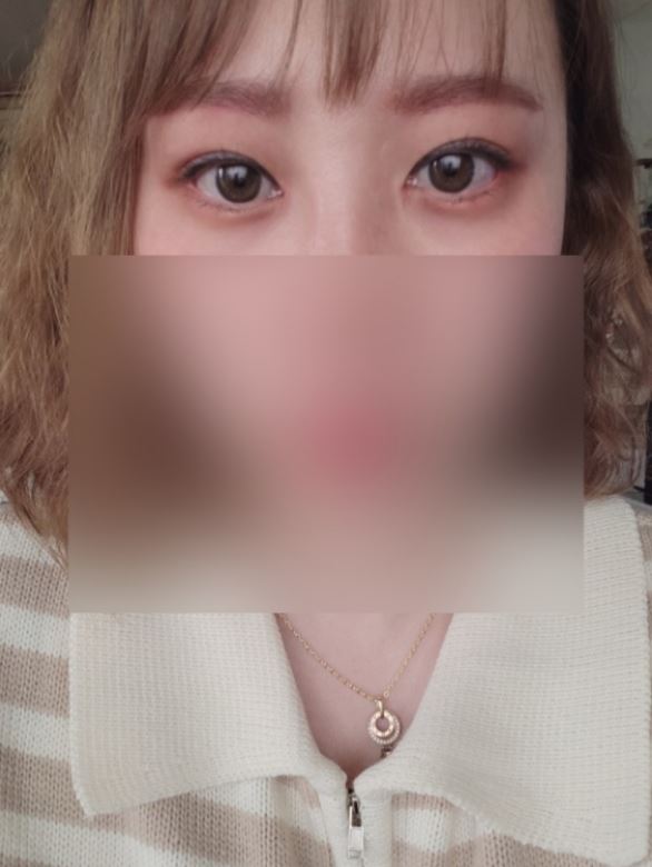 수술후기이미지