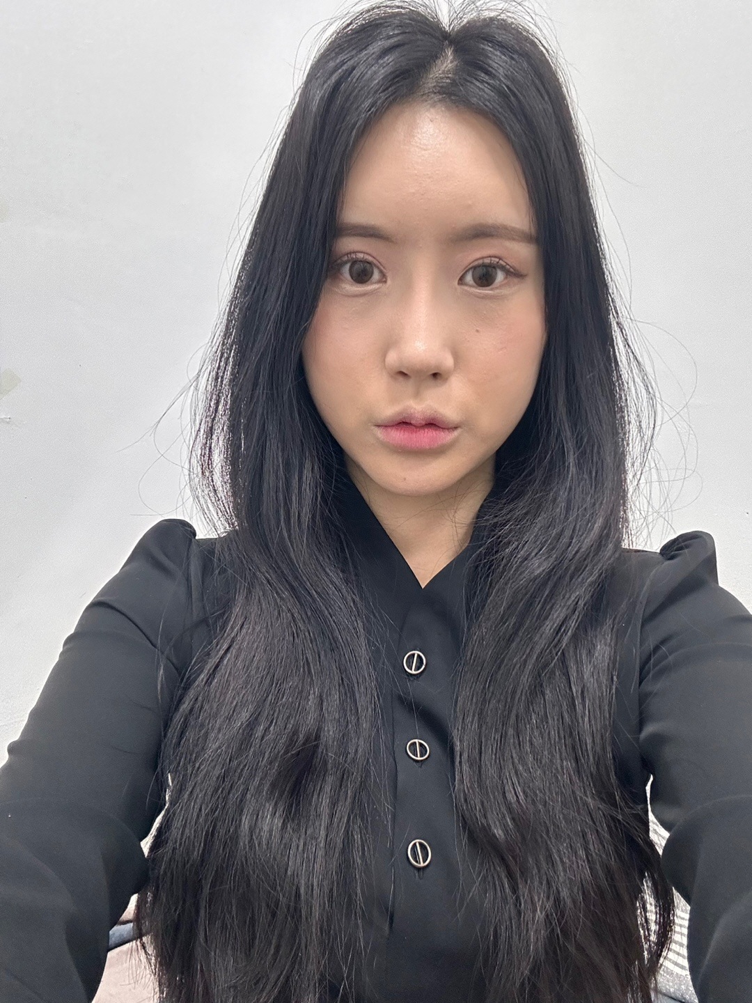 수술후기이미지