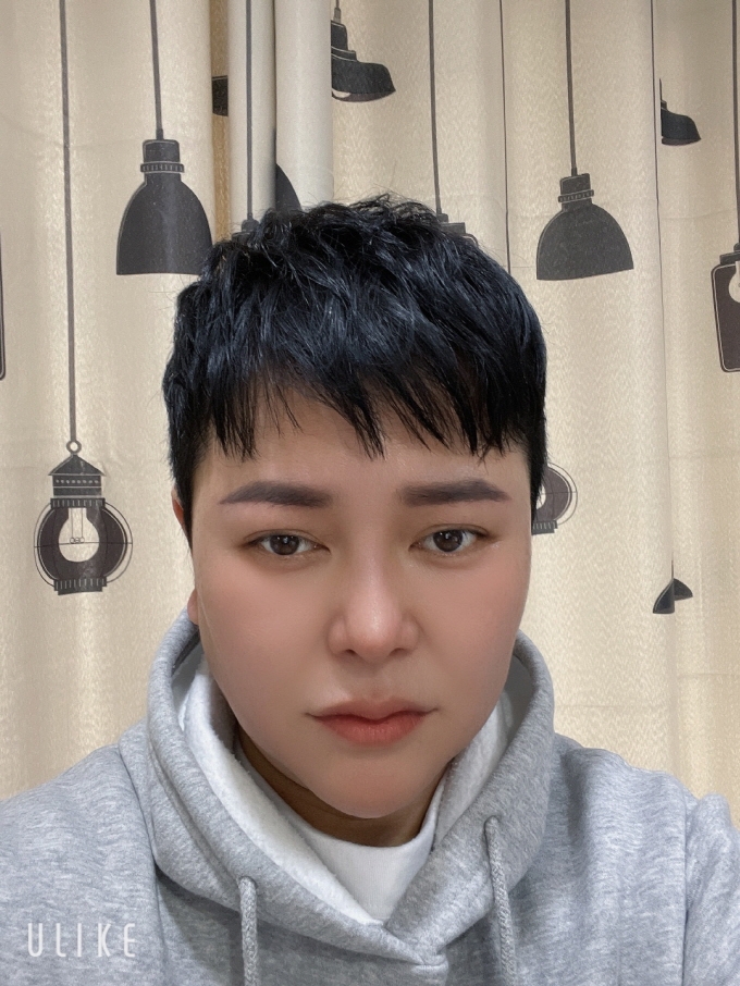 수술후기이미지