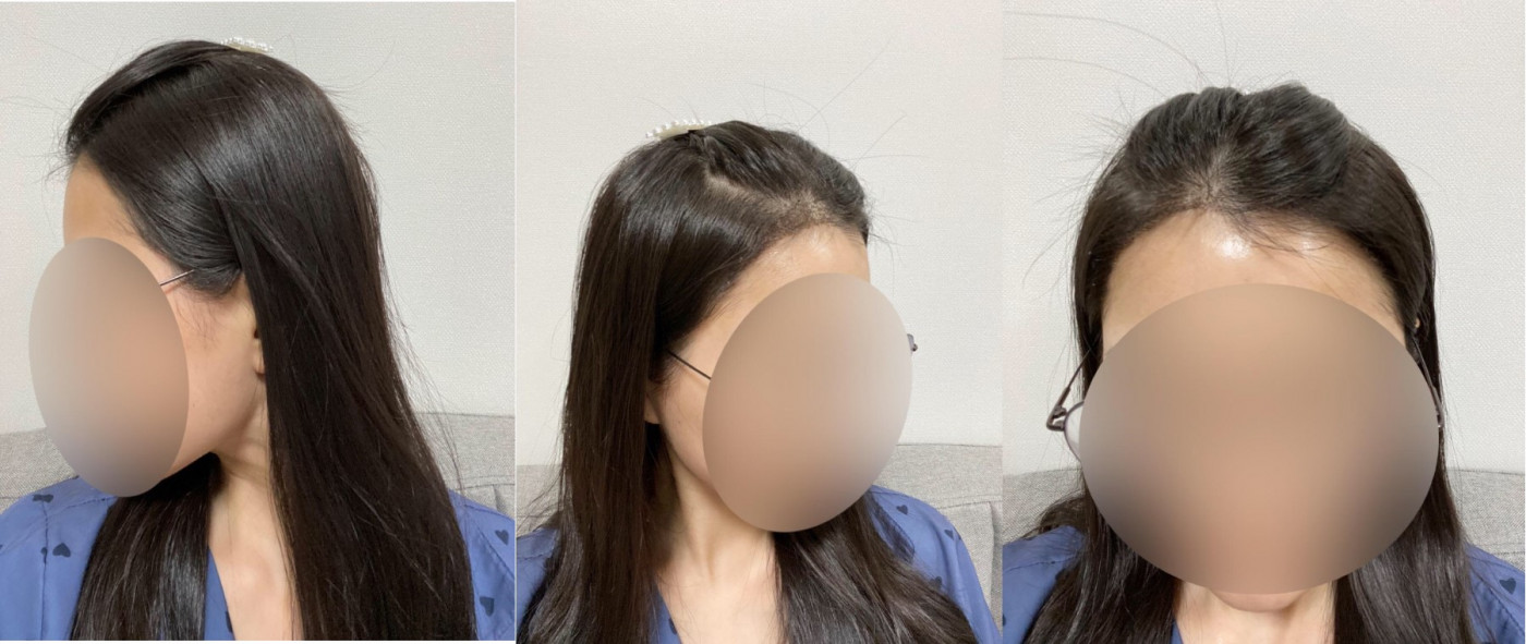 수술후기이미지