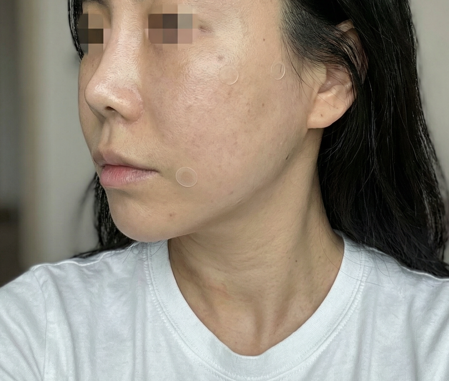 수술후기이미지