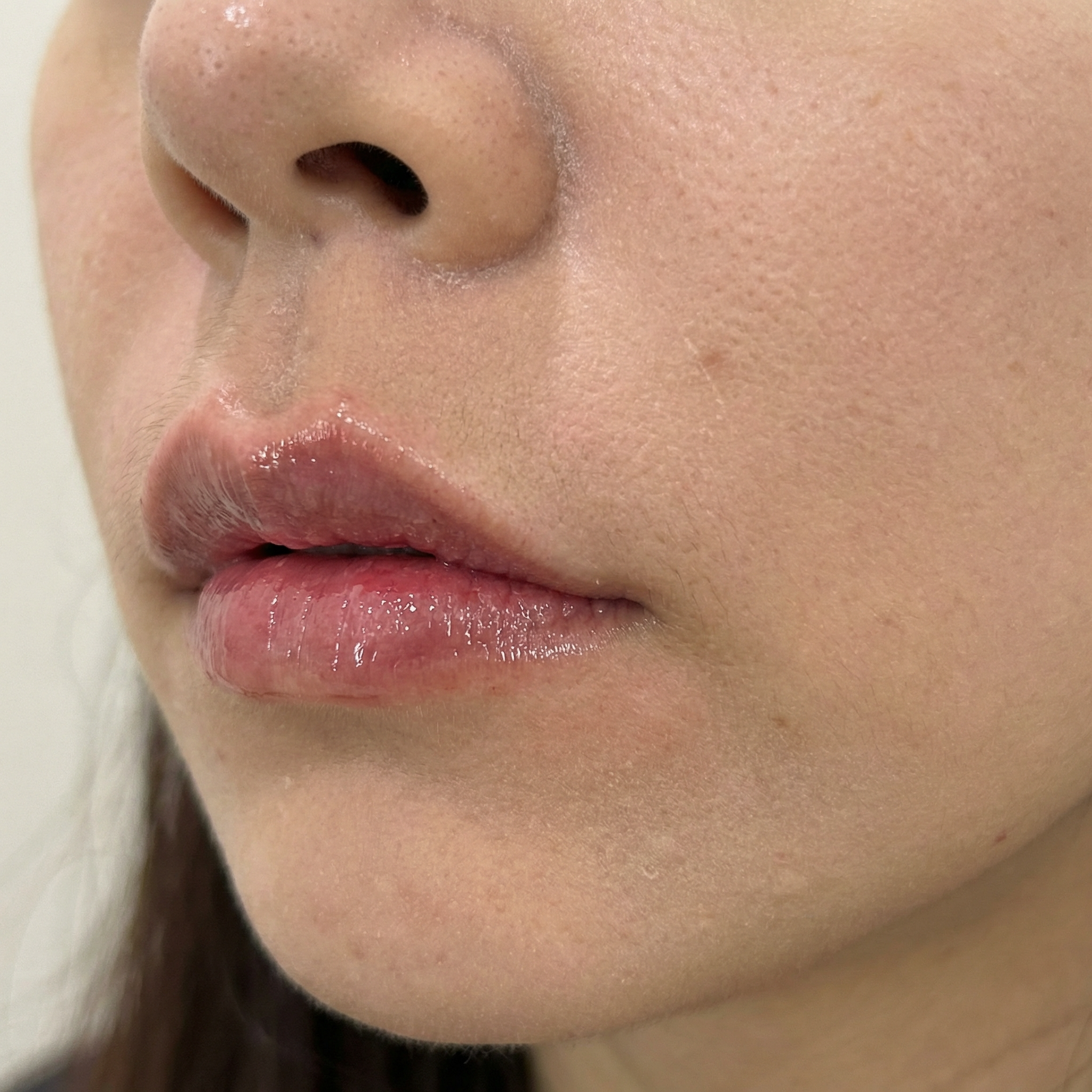 수술후기이미지