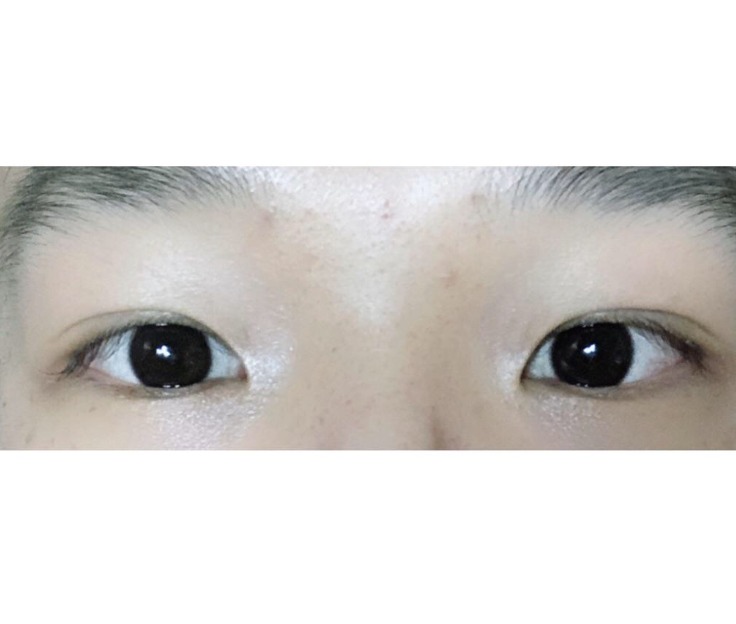 수술후기이미지