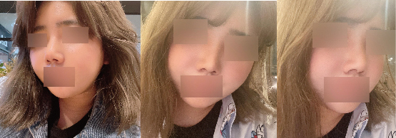 수술후기이미지