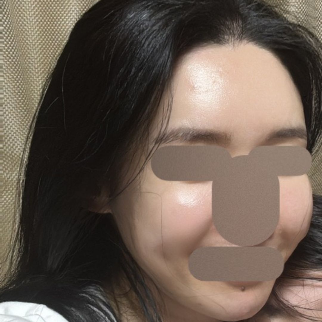 수술후기이미지