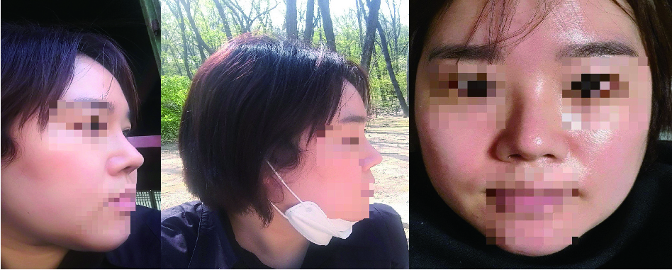 수술후기이미지