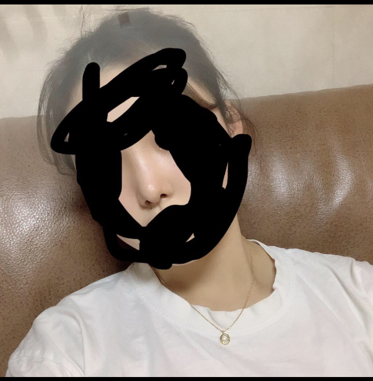 수술후기이미지