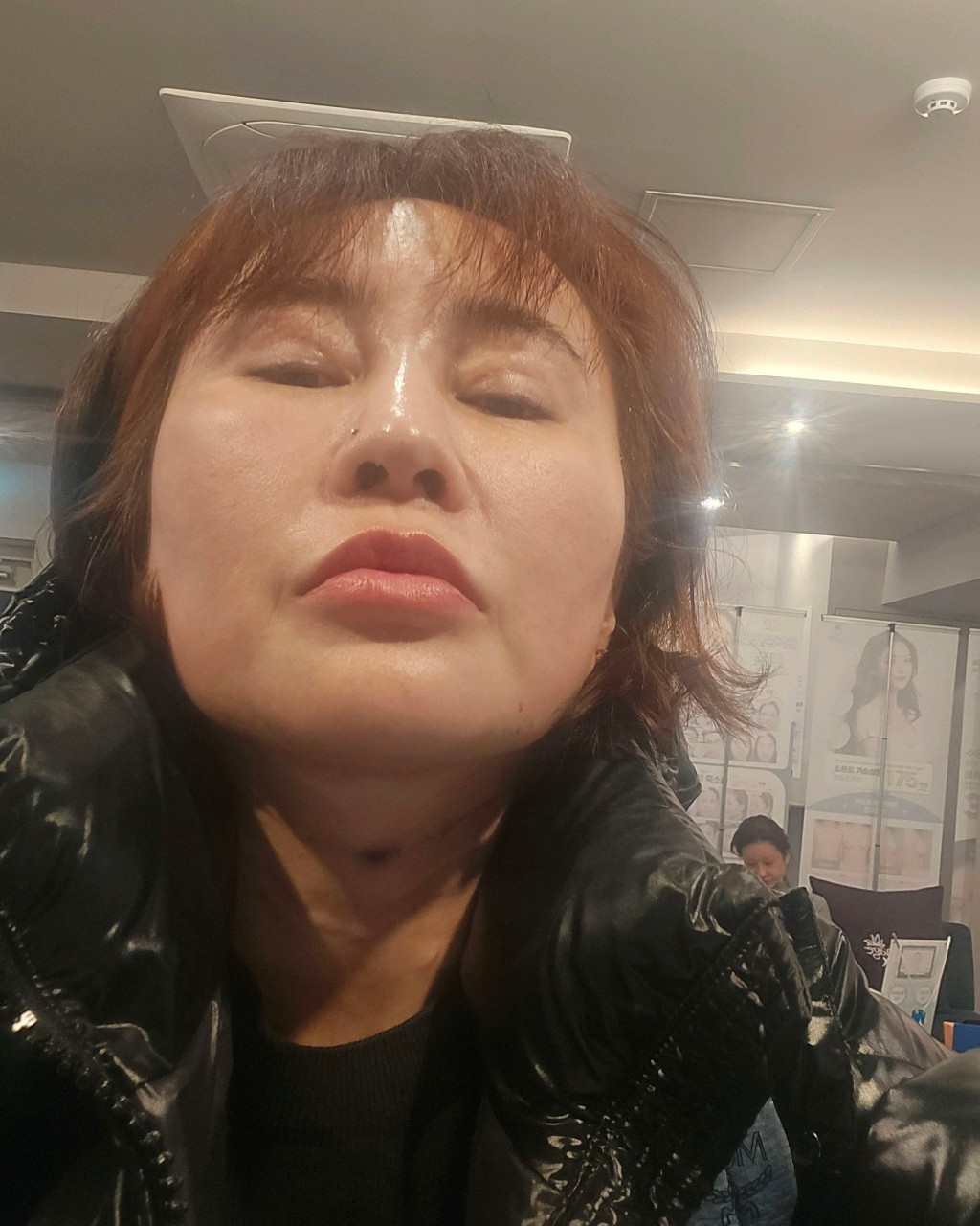 수술후기이미지