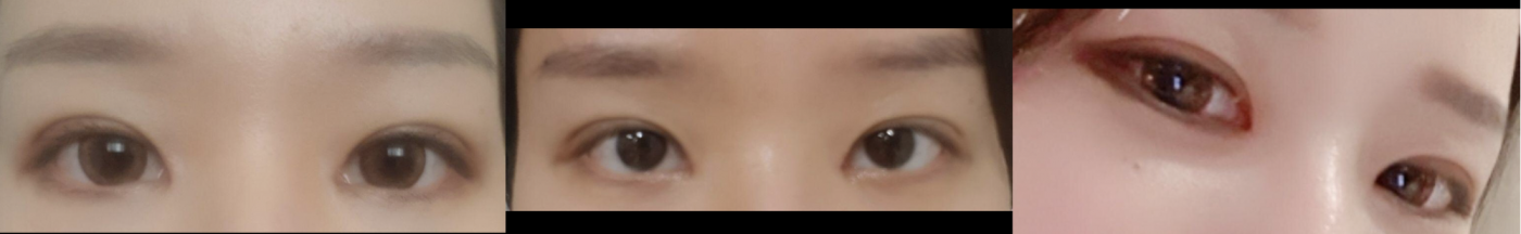 수술후기이미지