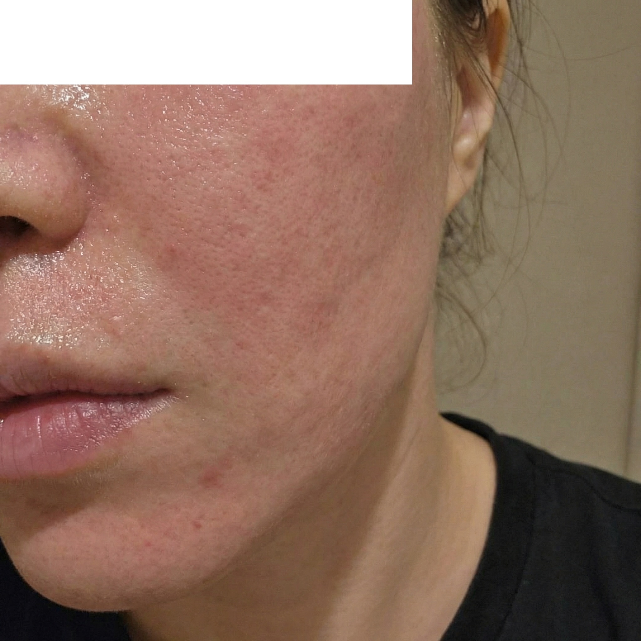 수술후기이미지