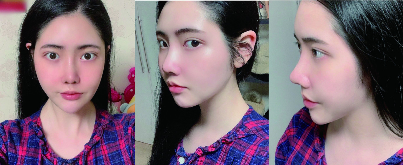 수술후기이미지