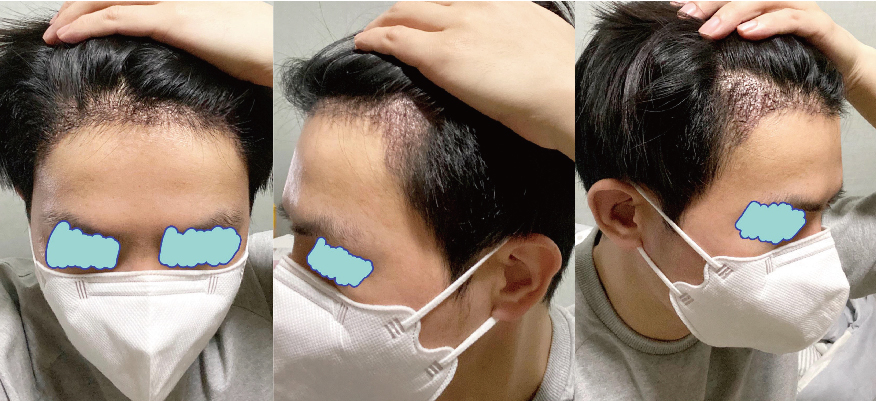 수술후기이미지