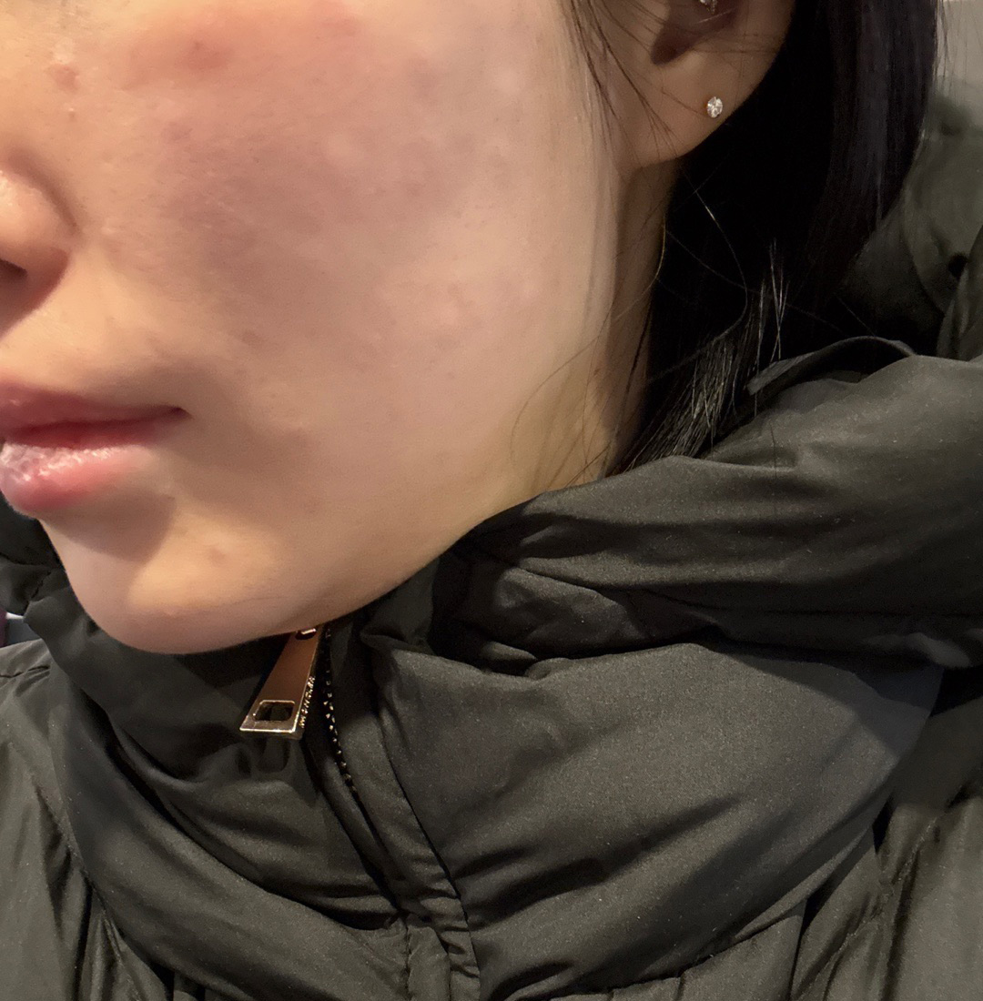 수술후기이미지