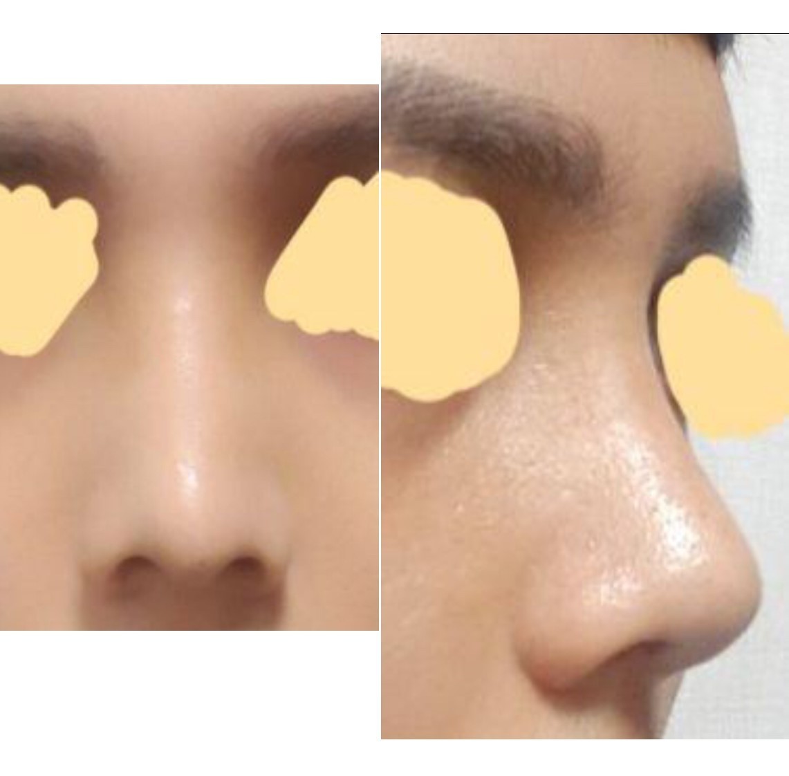 수술후기이미지