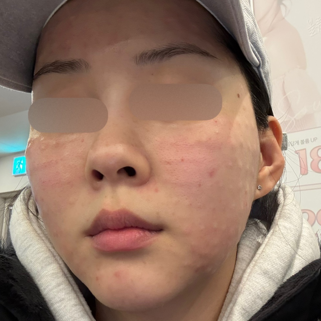 수술후기이미지