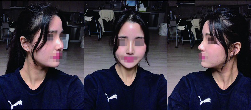 수술후기이미지