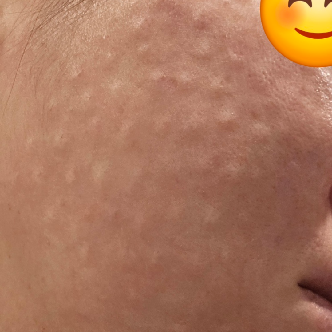 수술후기이미지