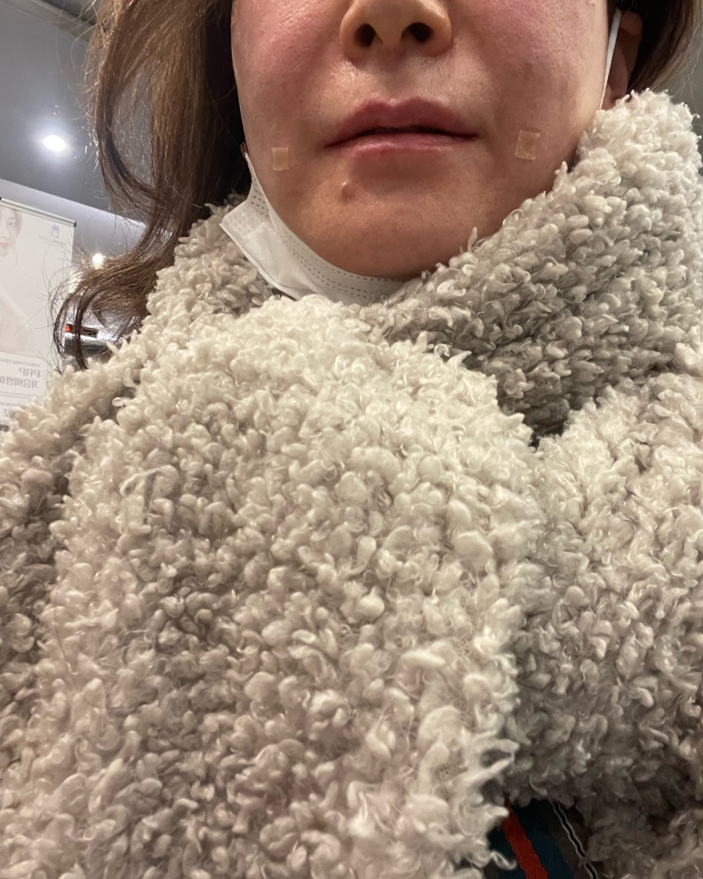 수술후기이미지