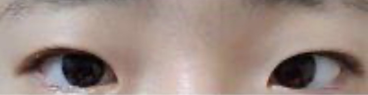 수술후기이미지