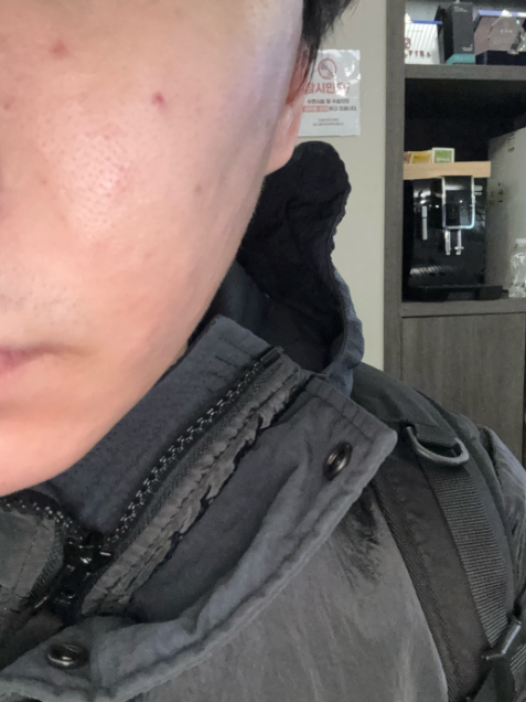 수술후기이미지