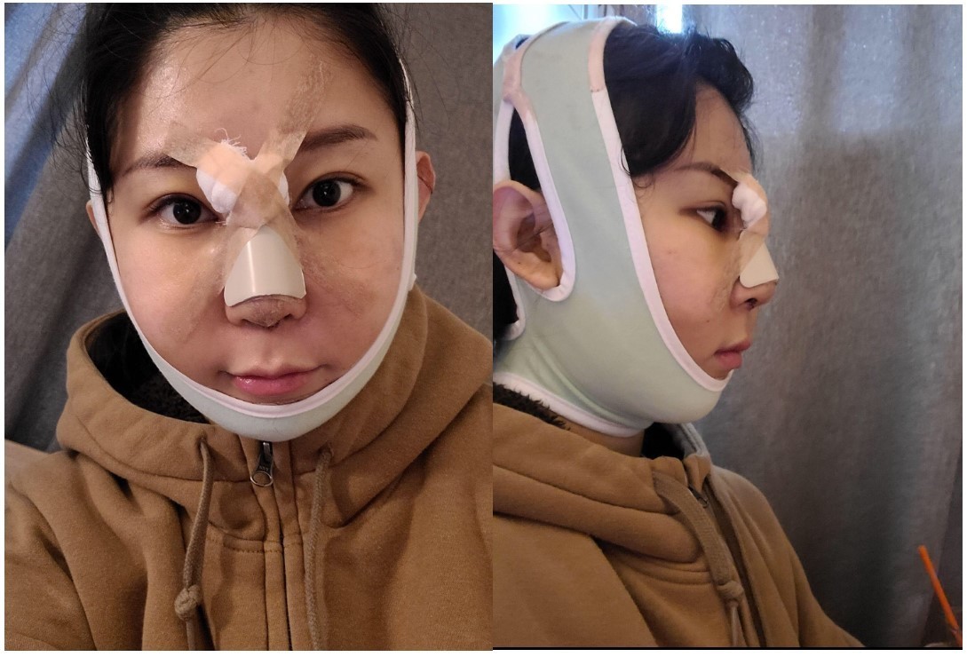 수술후기이미지