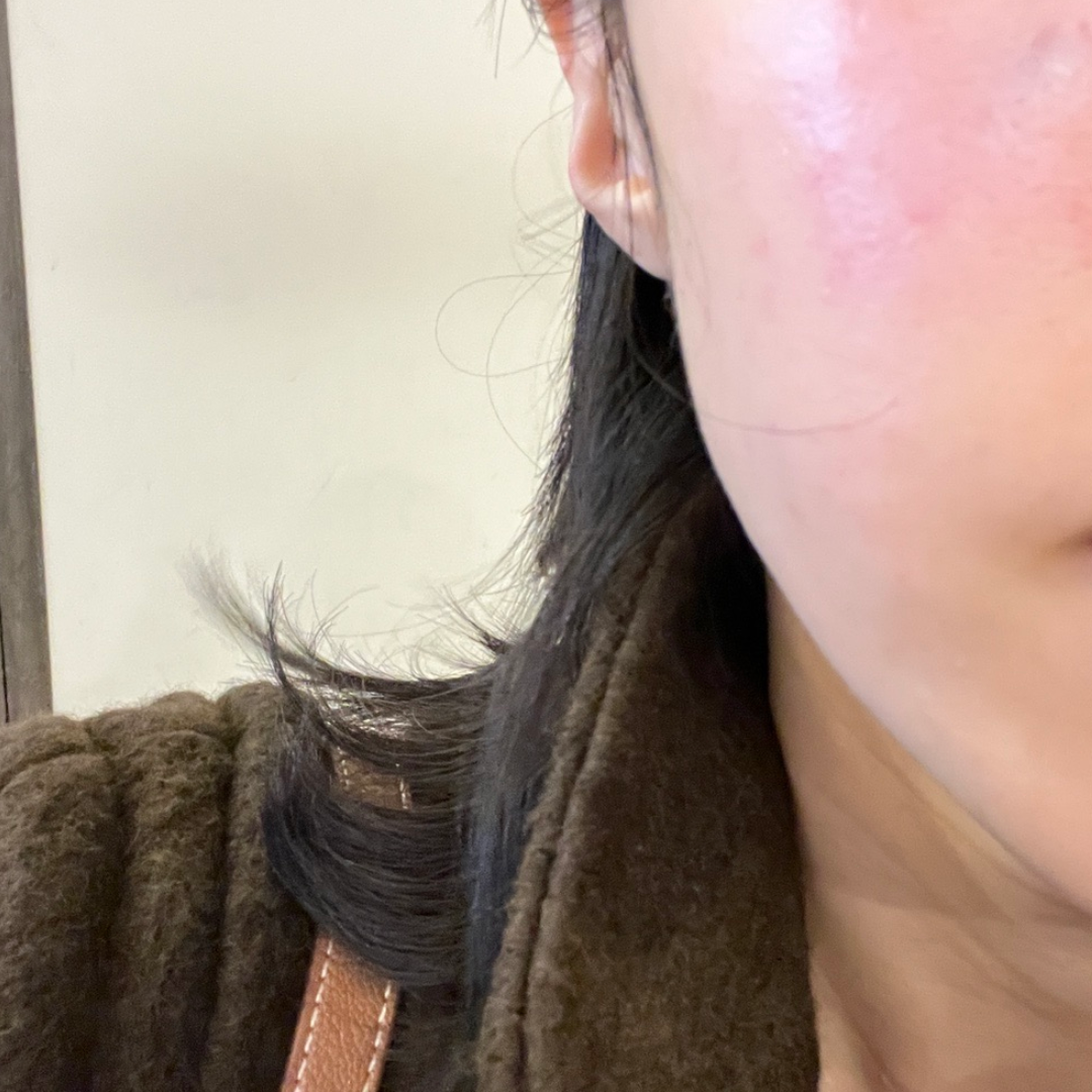 수술후기이미지