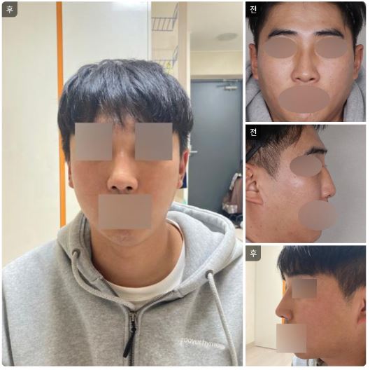 수술후기이미지