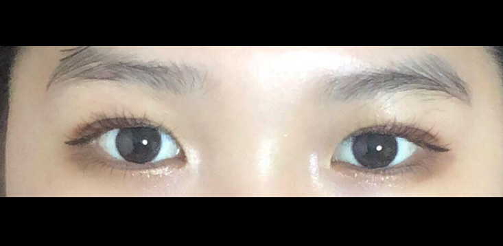 수술후기이미지