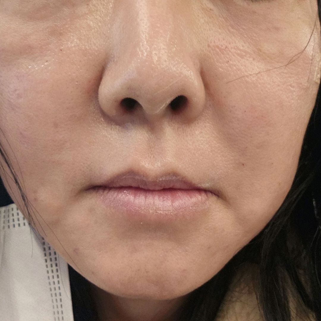 수술후기이미지