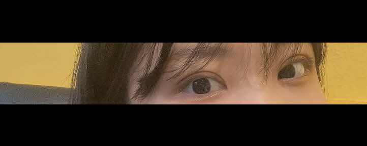 수술후기이미지