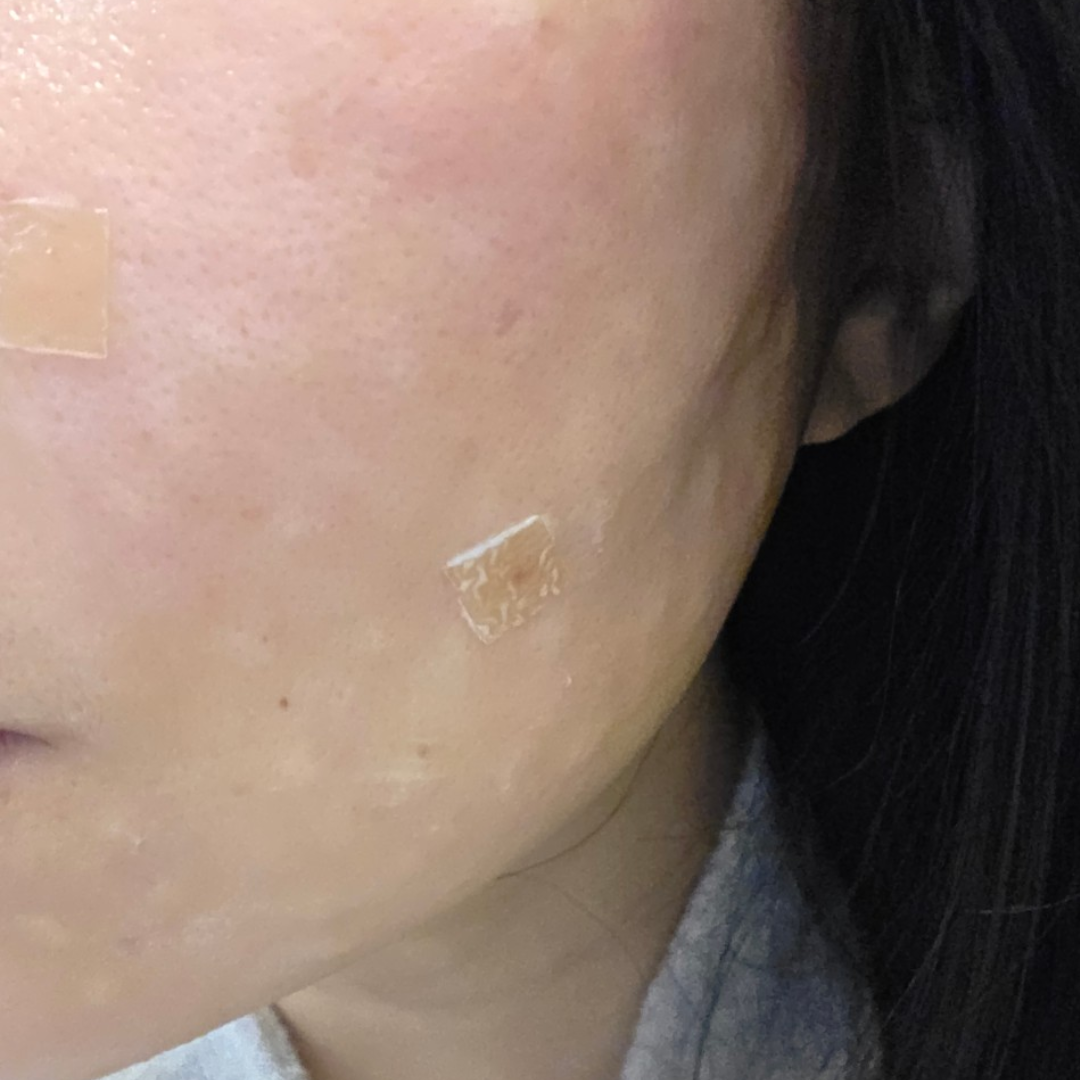 수술후기이미지